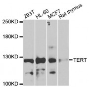 Western blot analysis of extracts of various cell lines, using TERT antibody (abx002167) at 1/1000 dilution.