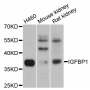 Western blot analysis of extracts of various cell lines, using IGFBP1 antibody (abx002168) at 1/1000 dilution.