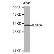 Western blot analysis of extracts of A-549 cells, using IL2RA antibody (abx002170).