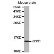 Western blot analysis of extracts of mouse brain, using KISS1 antibody (abx002171).