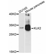 Western blot analysis of extracts of various cell lines, using KLK2 antibody (abx002174) at 1:3000 dilution.