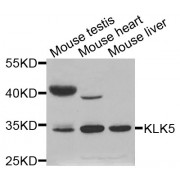 Western blot analysis of extracts of various cell lines, using KLK5 antibody (abx002175) at 1:400 dilution.