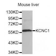 Western blot analysis of extracts of mouse liver, using KCNC1 antibody (abx002177).