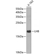 Western blot analysis of extracts of K-562 cells, using LHB antibody (abx002179) at 1:400 dilution.