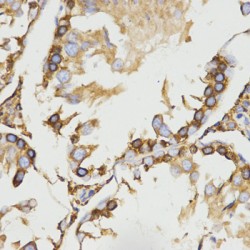 Low Density Lipoprotein Receptor Related Protein Associated Protein 1 (LRPAP1) Antibody