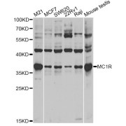 Western blot analysis of extracts of various cell lines, using MC1R antibody (abx002182) at 1:400 dilution.