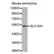 Western blot analysis of extracts of mouse seminoma, using SLC16A1 antibody (abx002186).