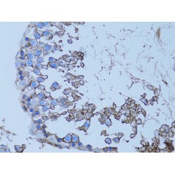 Monocarboxylate Transporter 1 (SLC16A1) Antibody