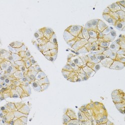 Monocarboxylate Transporter 1 (SLC16A1) Antibody