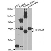 Western blot analysis of extracts of various cell lines, using SLC16A4 Antibody (abx002187) at 1/1000 dilution.