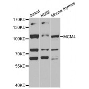 Western blot analysis of extracts of various cell lines, using MCM4 antibody (abx002188) at 1:400 dilution.