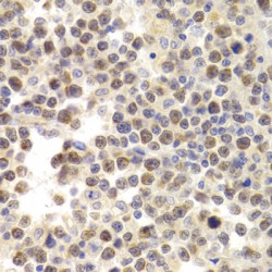 Minichromosome Maintenance Deficient 4 (MCM4) Antibody