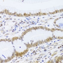 Minichromosome Maintenance Deficient 4 (MCM4) Antibody