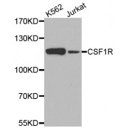 Western blot analysis of extracts of various cell lines, using CSF1R antibody (abx002189) at 1/500 dilution.