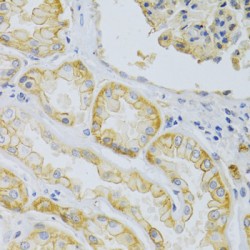 Multidrug Resistance Associated Protein 1 (ABCC1) Antibody