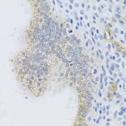 Multidrug Resistance Associated Protein 1 (ABCC1) Antibody