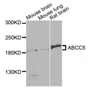 Western blot analysis of extracts of various cell lines, using ABCC5 antibody (abx002191) at 1/1000 dilution.