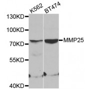 Western blot analysis of extracts of various cell lines, using MMP25 antibody (abx002193) at 1:400 dilution.