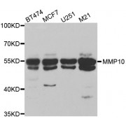 Western blot analysis of extracts of various cell lines, using MMP10 antibody (abx002194) at 1:400 dilution.