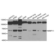 Western blot analysis of extracts of various cell lines, using MMP11 antibody (abx002195) at 1/1000 dilution.