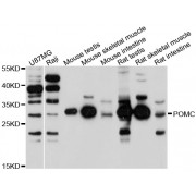 Western blot analysis of extracts of various cell lines, using POMC antibody (abx002196) at 1/1000 dilution.
