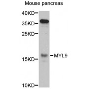 Western blot analysis of extracts of mouse pancreas, using MYL9 antibody (abx002197) at 1:3000 dilution.