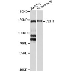 Cadherin-1 / E-Cadherin (CDH1) Antibody