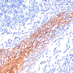 Cadherin-1 / E-Cadherin (CDH1) Antibody