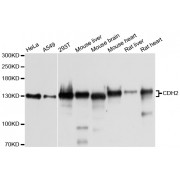 Western blot analysis of extracts of various cell lines, using CDH2 antibody (abx002200) at 1/1000 dilution.