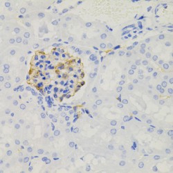 NPHS1, Nephrin (NPHS1) Antibody