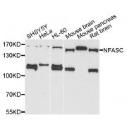 Western blot analysis of extracts of various cell lines, using NFASC antibody (abx002202) at 1/1000 dilution.