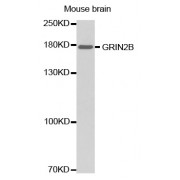 Western blot analysis of extracts of mouse brain, using GRIN2B antibody (abx002204).