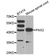 Western blot analysis of extracts of various cell lines, using PAX2 antibody (abx002211) at 1/500 dilution.