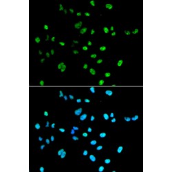 Paired Box Protein Pax-2 (PAX2) Antibody