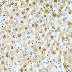 Progesterone-Induced-Blocking Factor 1 (PIBF1) Antibody