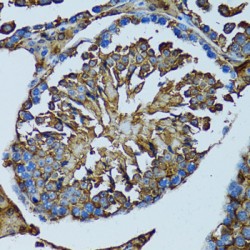 Thioredoxin-Dependent Peroxide Reductase, Mitochondrial (PRDX3) Antibody