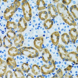 Thioredoxin-Dependent Peroxide Reductase, Mitochondrial (PRDX3) Antibody