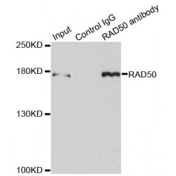 RAD50 Double Strand Break Repair Protein (RAD50) Antibody