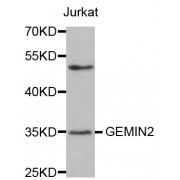 Western blot analysis of extracts of Jurkat cells, using GEMIN2 antibody (abx002220) at 1/500 dilution.
