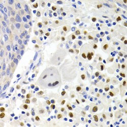 Gem Nuclear Organelle Associated Protein 2 (GEMIN2) Antibody