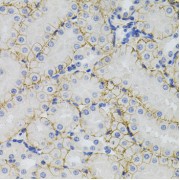 Immunohistochemistry of paraffin-embedded mouse kidney using SLC1A4 antibody (abx002221) (40x lens).