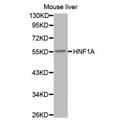 Western blot analysis of extracts of mouse liver, using HNF1A antibody (abx002223).