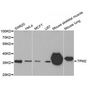 Western blot analysis of extracts of various cell lines, using TPM2 antibody (abx002226) at 1:400 dilution.