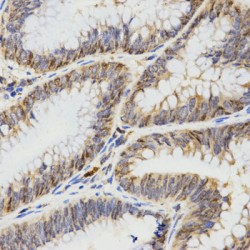 Tropomyosin Beta Chain (TPM2) Antibody