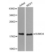Western blot analysis of extracts of various cell lines, using SUMO4 antibody (abx002229) at 1:800 dilution.