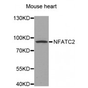 Western blot analysis of extracts of mouse heart, using NFATC2 antibody (abx002232) at 1/500 dilution.