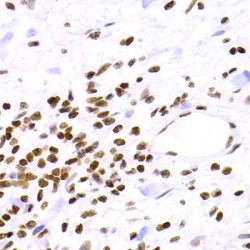 Nuclear Factor NF-Kappa-B P100 Subunit (NFKB2) Antibody