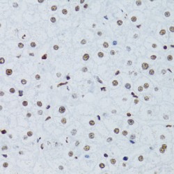 Nuclear Factor NF-Kappa-B P100 Subunit (NFKB2) Antibody