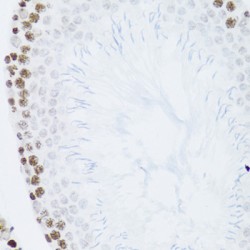 Nuclear Factor NF-Kappa-B P100 Subunit (NFKB2) Antibody