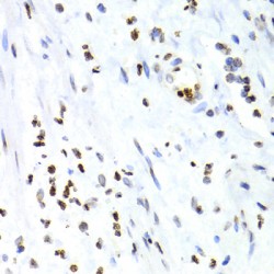Nuclear Factor NF-Kappa-B P100 Subunit (NFKB2) Antibody